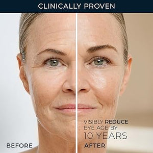 RoC Retinol Correxion Under Eye Cream