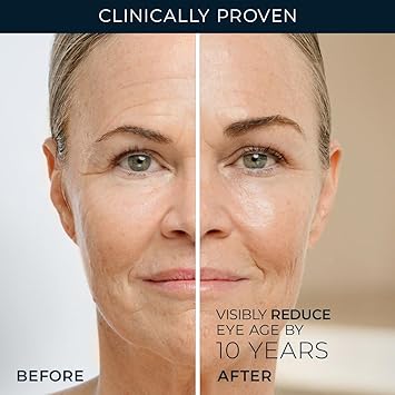 RoC Retinol Correxion Under Eye Cream