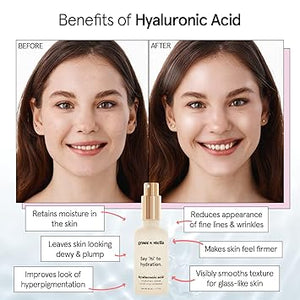grace & stella Award Winning Hyaluronic Acid Serum (50ml/1.7 fl oz)