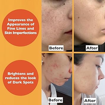 Vitamin C Serum For Face – Anti-Aging Facial Serum with Vitamin C