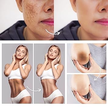 FAMIROSA Intimate Area Dark Spot Corrector