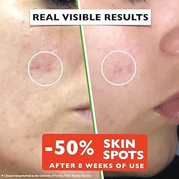 Vitamin C Serum For Face – Anti-Aging Facial Serum with Vitamin C