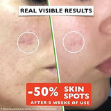Vitamin C Serum For Face – Anti-Aging Facial Serum with Vitamin C