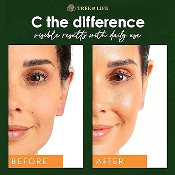 Tree of Life Beauty Vitamin C Skin Care Set