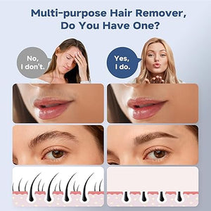 Facial Hair Removal for Women