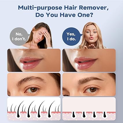 Facial Hair Removal for Women