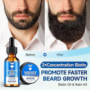 Beard Growth Oil & Beard Balm - Beard Growth Kit